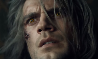 The Witcher : Henry Cavill a failli devenir aveugle à cause de Geralt De Riv